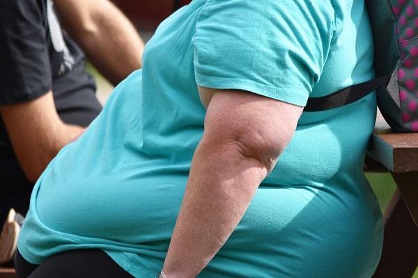 نیمی از مبتلایان به کرونا در آمریکا افراد چاق هستند