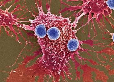 استفاده از سلول های سرطانی در برابر همان بیماری